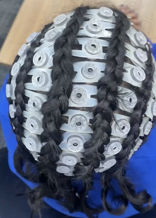 An overhead photo of the SEVO Clips in someone's hair. The hair is styled in cornrows